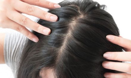Rambut Menipis Karena Kebiasaan Ini, Jangan Abaikan!
