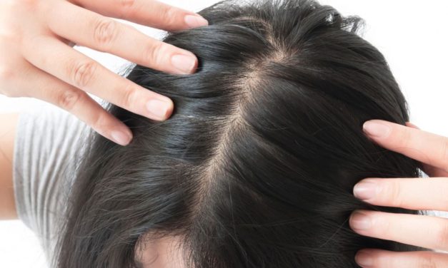 Rambut Menipis Karena Kebiasaan Ini, Jangan Abaikan!