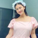 Felicya Angelista Jawab Isu Operasi Plastik, Ini Fakta Sebenarnya