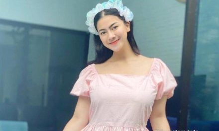 Felicya Angelista Jawab Isu Operasi Plastik, Ini Fakta Sebenarnya